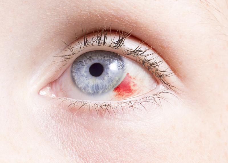 Аллергия на лице красные пятна у ребенка фото